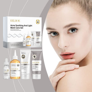 Acne light print care kit – glycolic acid niacinamide &
