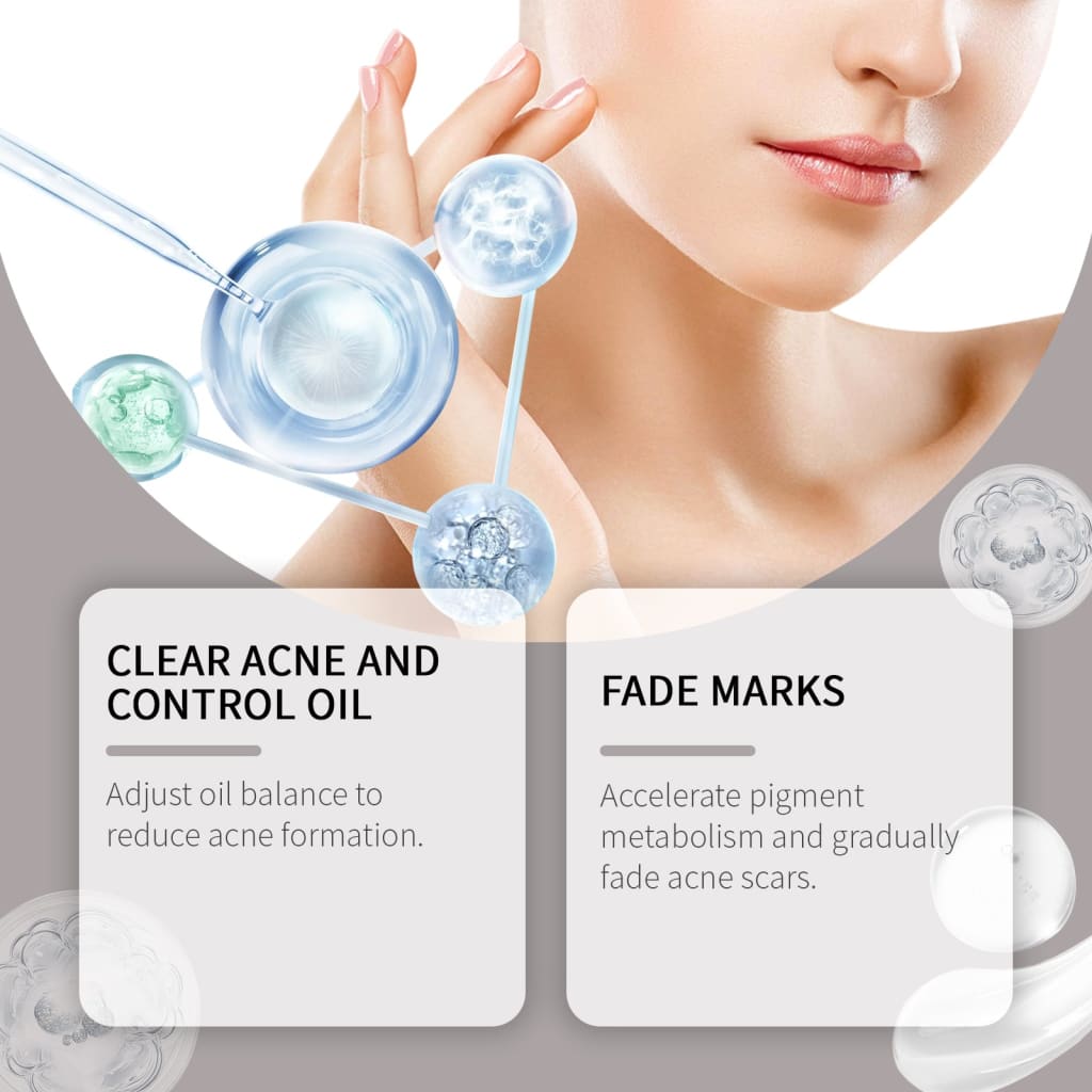 Acne light print care kit – glycolic acid niacinamide &