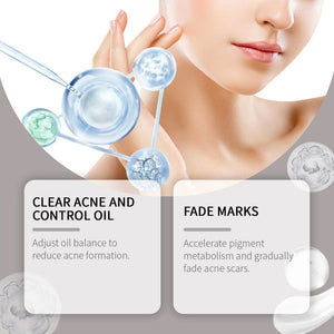 Acne light print care kit – glycolic acid niacinamide &