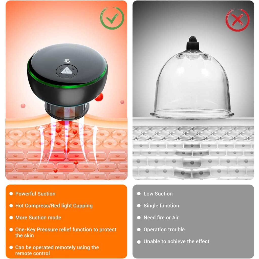 Electric smart cupping therapy set – 5-in-1 remote control