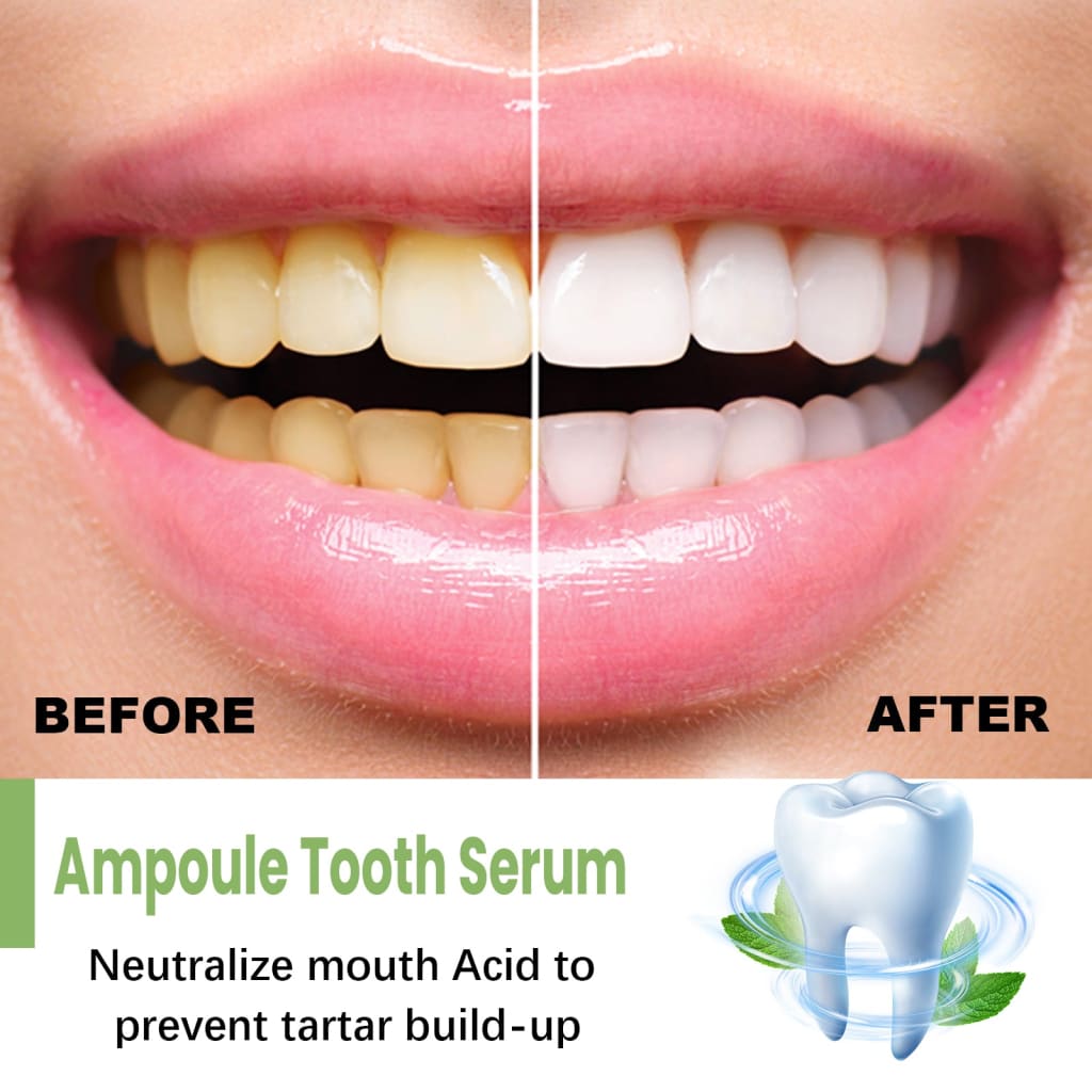 Teeth whitening serum for bad breath sensitive gums & stain