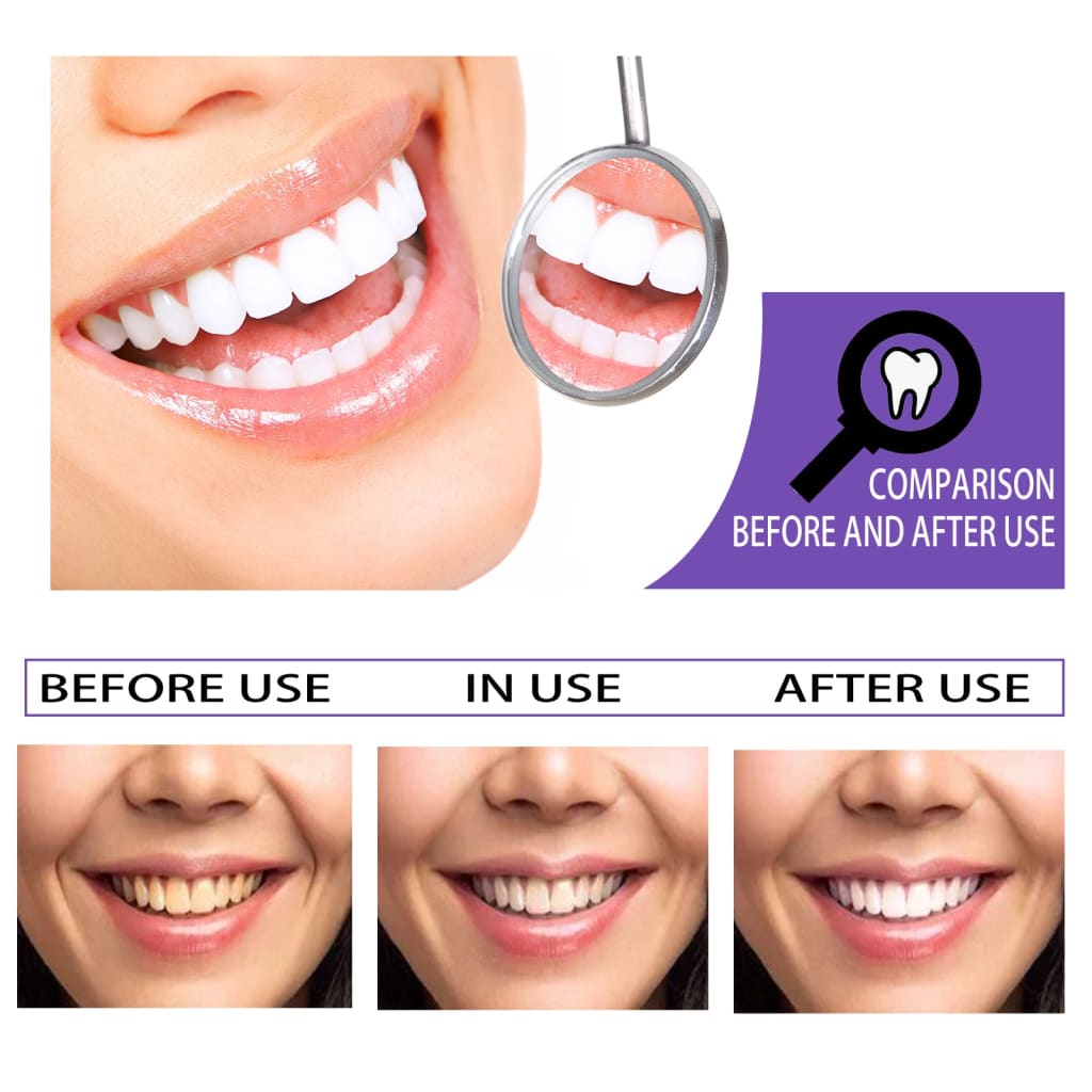 White tooth toothpaste – teeth whitening with sorbitol &