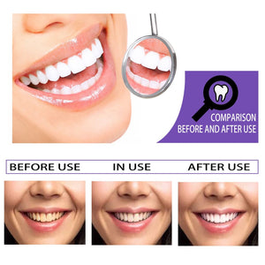 White tooth toothpaste – teeth whitening with sorbitol &